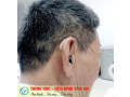 Máy trợ thính - máy trợ thính cho người nghe kém