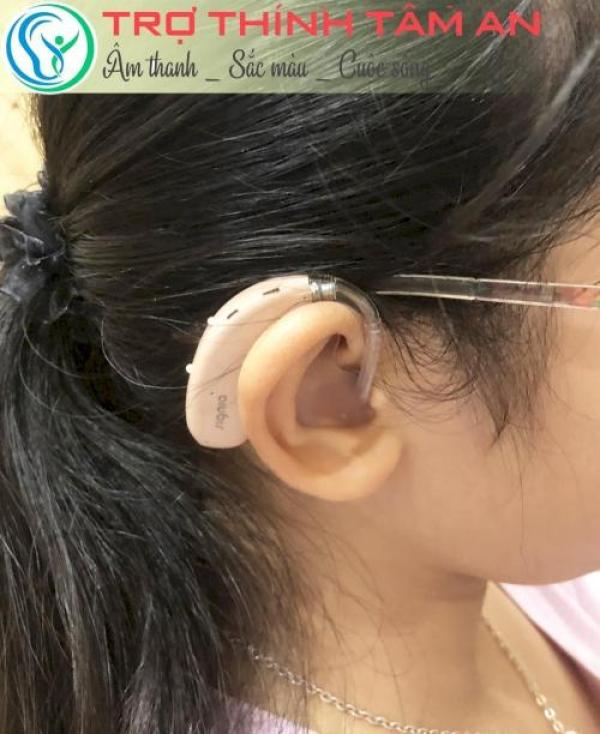 Máy trợ thính đeo sau tai - máy trợ thính chính hãng Máy trợ thính đeo sau tai - máy trợ thính chính hãng