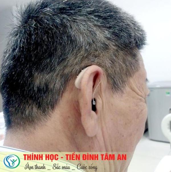 Máy trợ thính đeo sau tai - máy trợ thính chính hãng Máy trợ thính đeo sau tai - máy trợ thính chính hãng