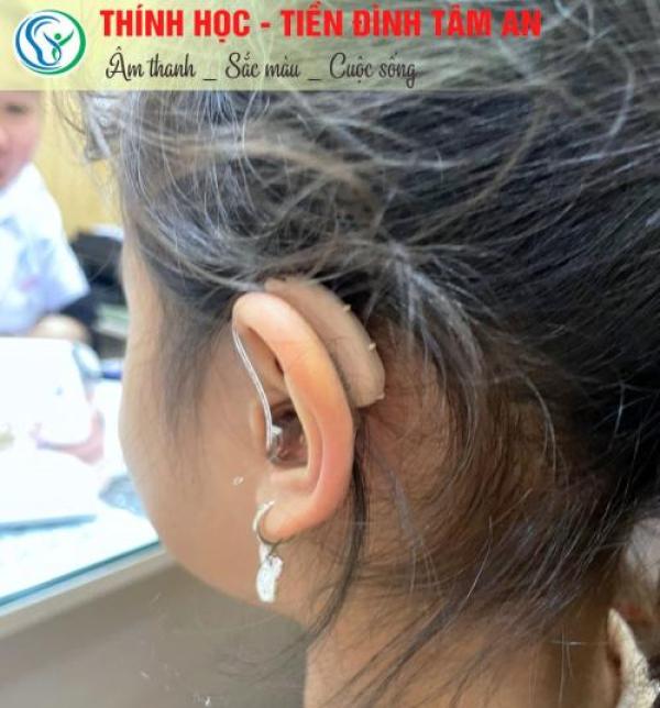 Máy trợ thính đeo sau tai - máy trợ thính chính hãng Máy trợ thính đeo sau tai - máy trợ thính chính hãng