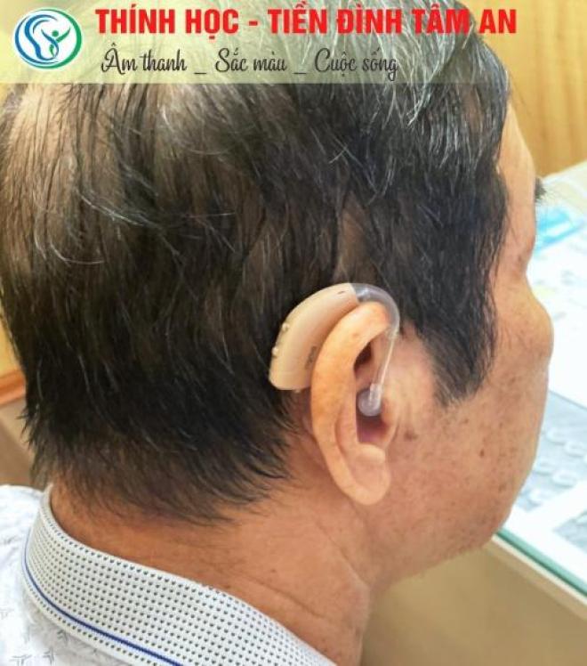 Máy trợ thính đeo sau tai - máy trợ thính chính hãng Máy trợ thính đeo sau tai - máy trợ thính chính hãng