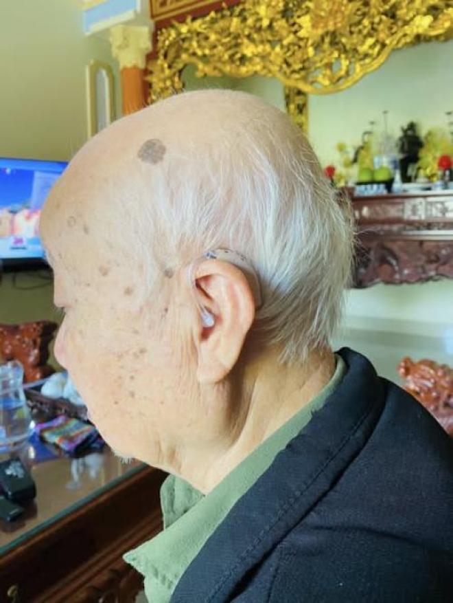 Đeo máy trợ thính có làm thính lực kém đi không? Đeo máy trợ thính có làm thính lực kém đi không?