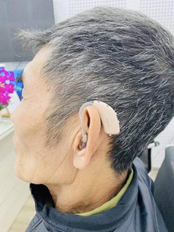 Vì sao cần làm khuôn tai dành cho máy sau tai